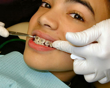 Kids Raleigh: Orthodontists - Fun 4 Raleigh Kids